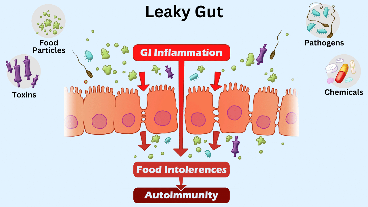 The Gut-Immune Connection: How Gut Health Influences Autoimmunity